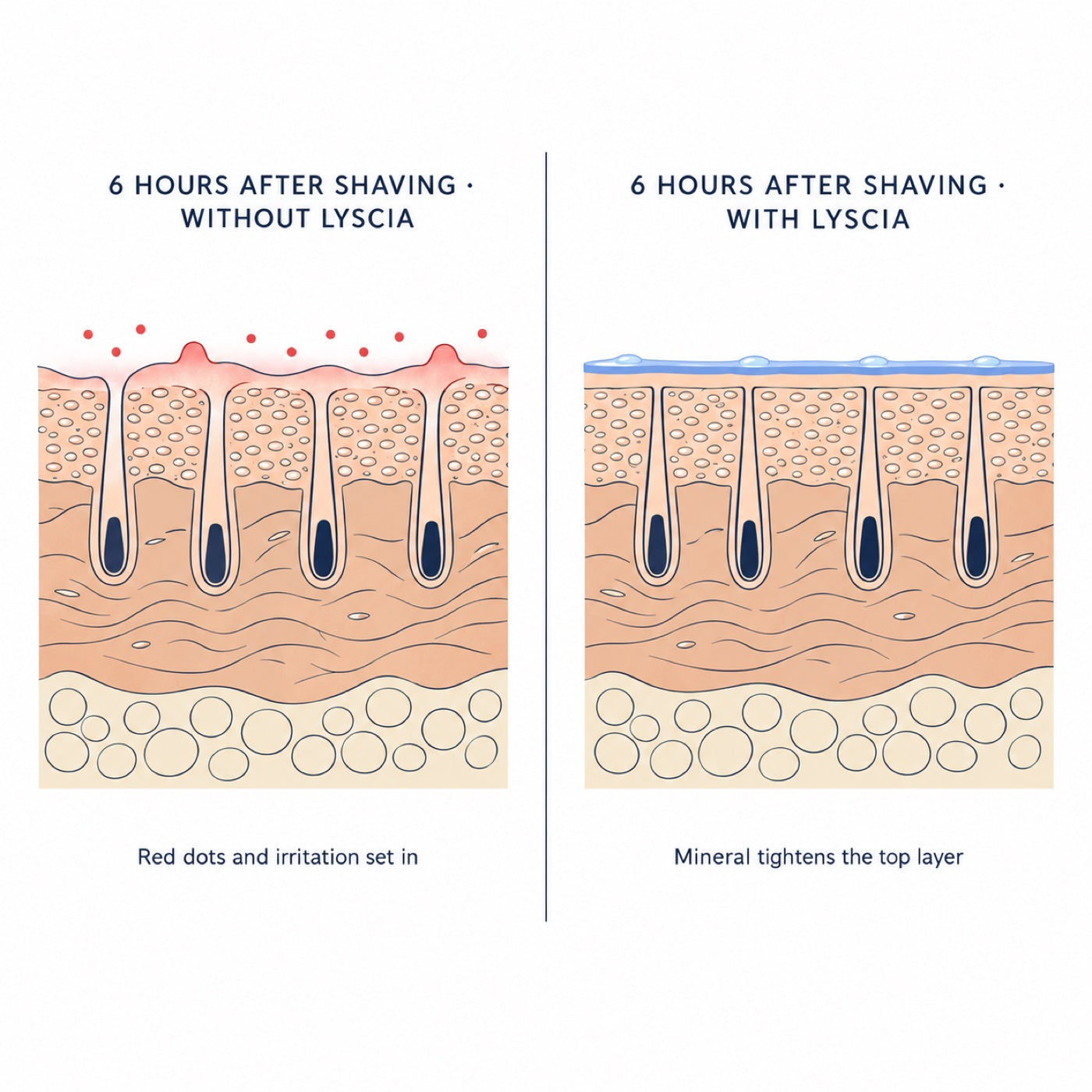 Lyscia Mineral